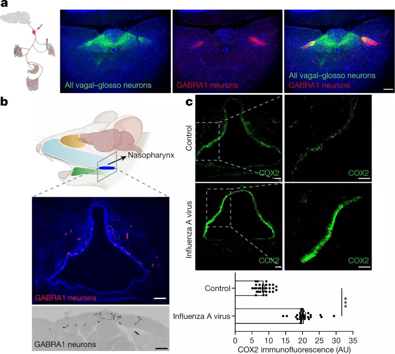 Exploring how the brain senses infection