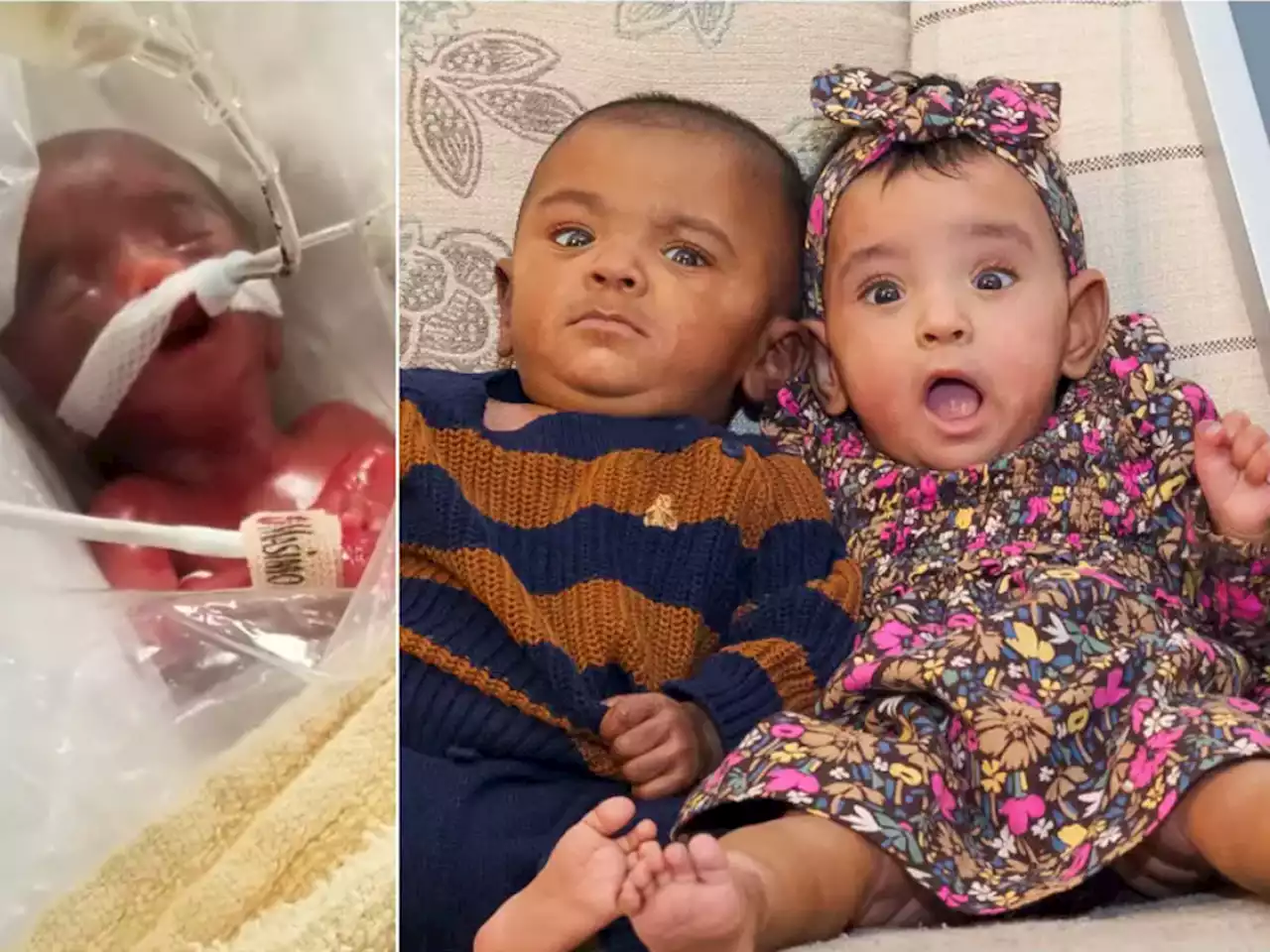 Ontario couple's twins, born at 22 weeks, are world's 'most premature' birth