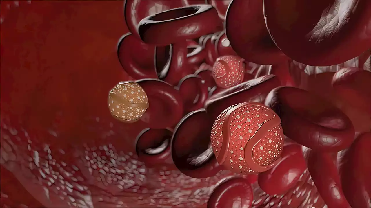 Investigating treat-to-target low-density lipoprotein-cholesterol versus high-intensity statins for coronary artery disease