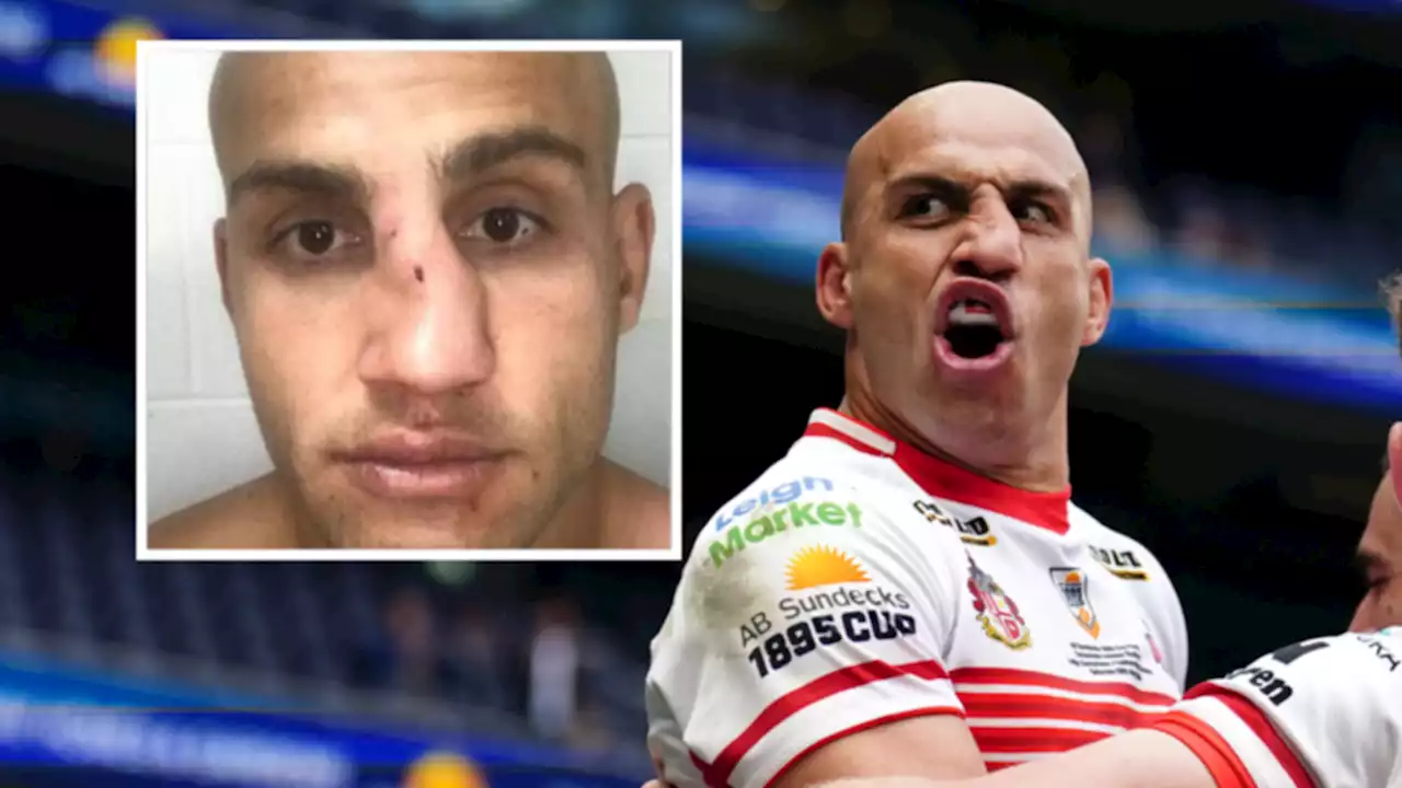 Premiership star unleashes rant on NRL after game ‘ruined’ his face