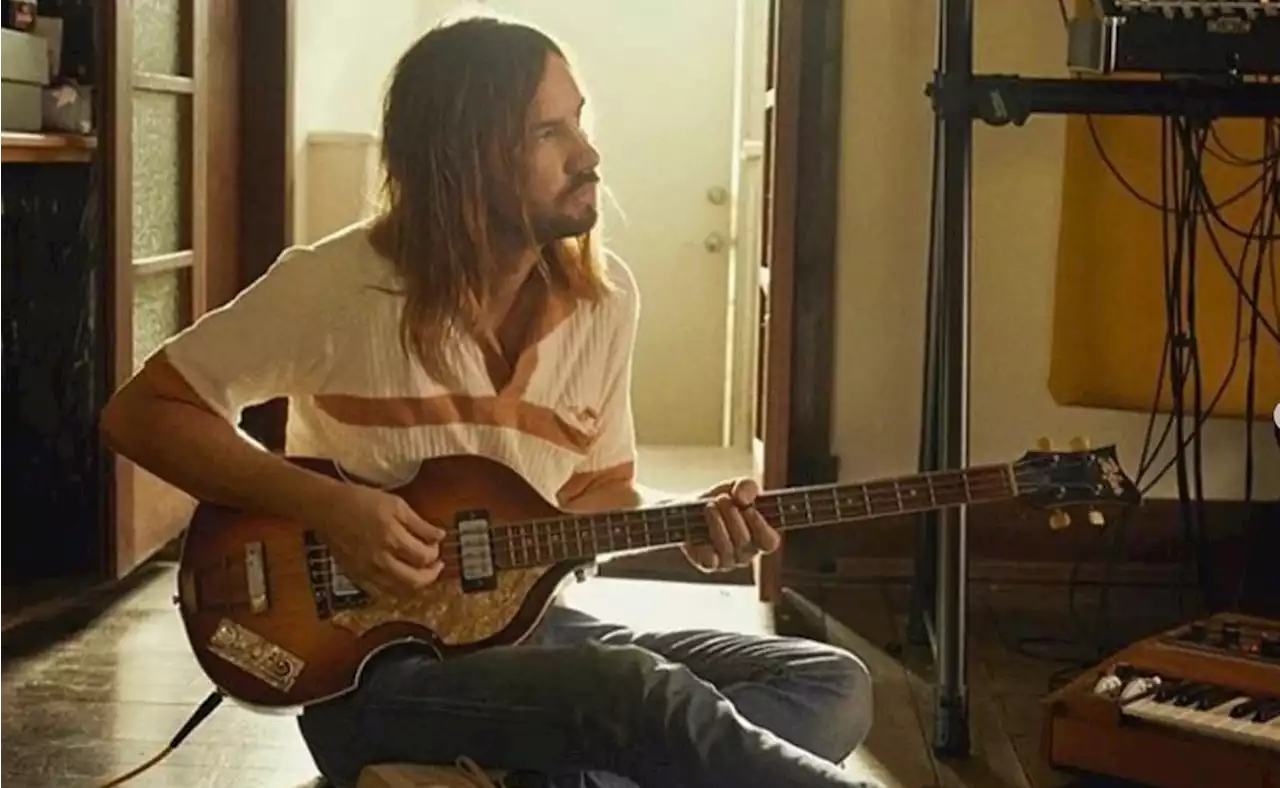 Kevin Parker, de Tame Impala, se fractura la cadera: ¿qué pasará con los concierto en CDMX?