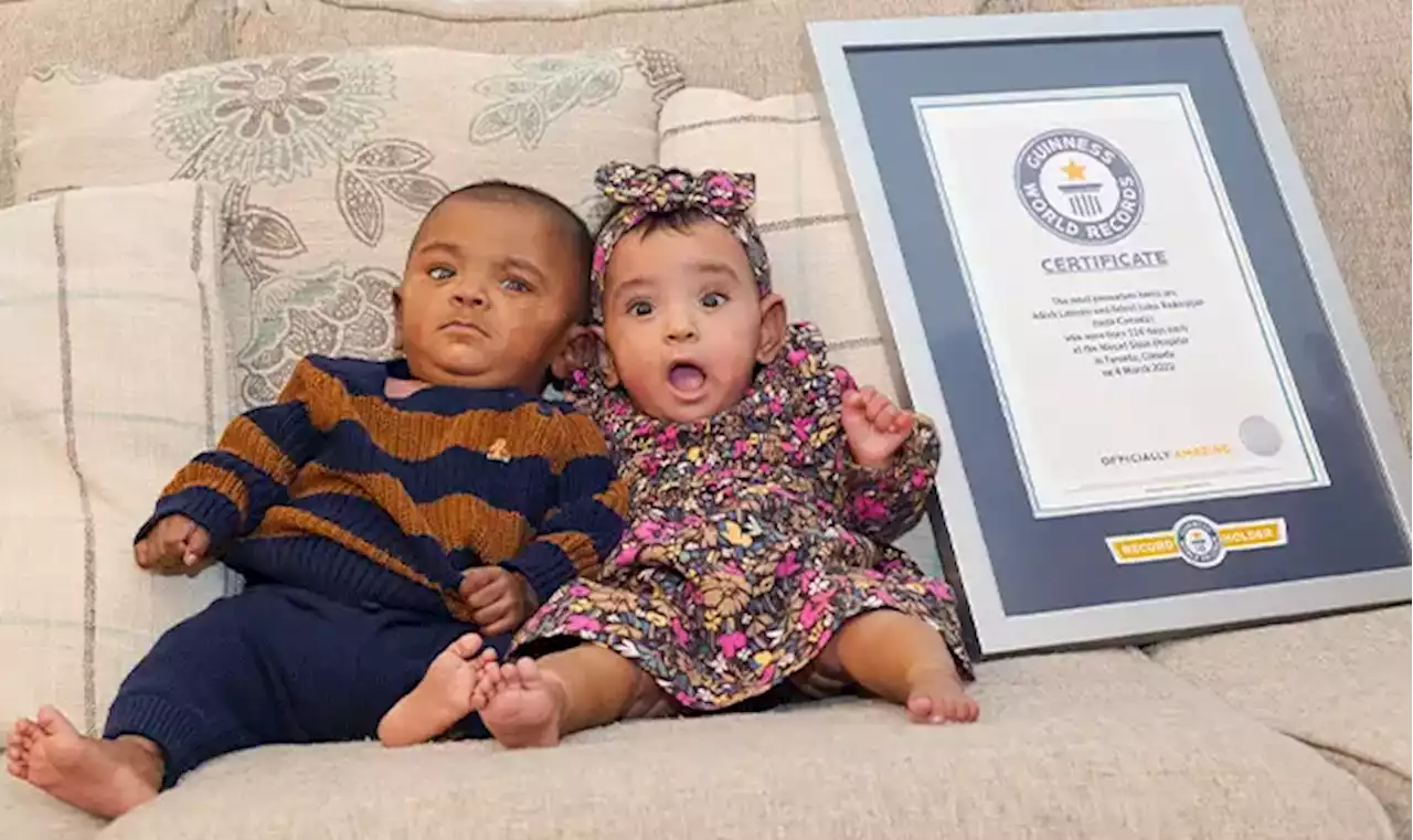 Born 4 months early, these Canadian preemie twins set Guinness World Record | Globalnews.ca