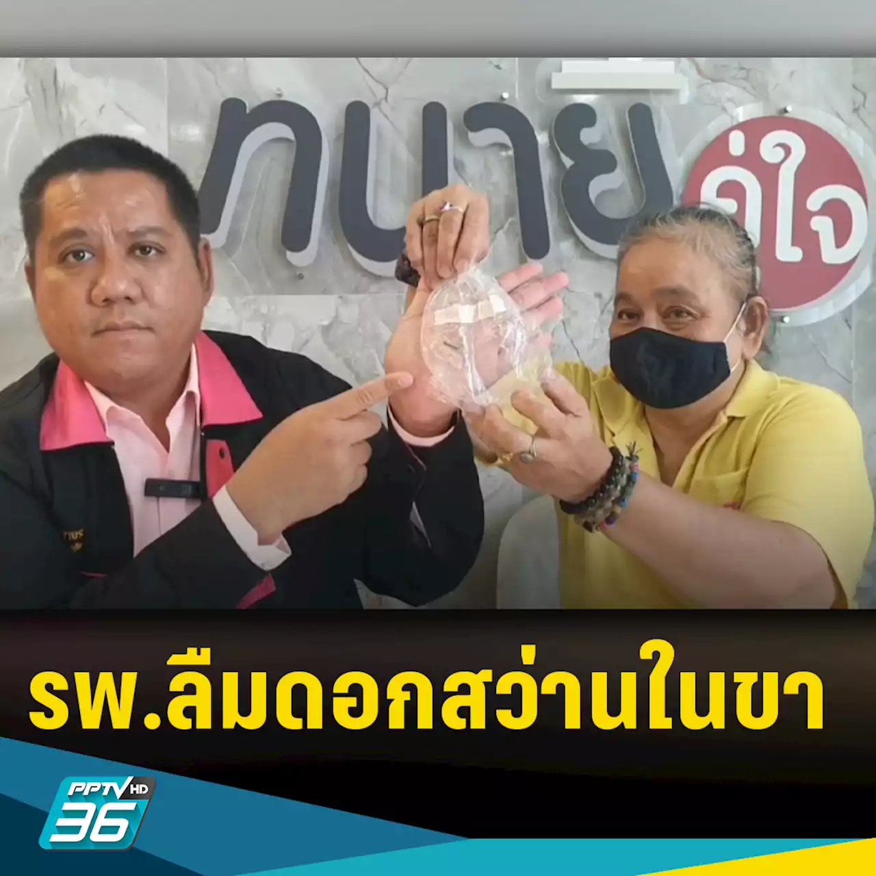 หญิงร้อง รพ. ลืมดอกสว่านในขา 6 ปี จนอักเสบเดินไม่ได้