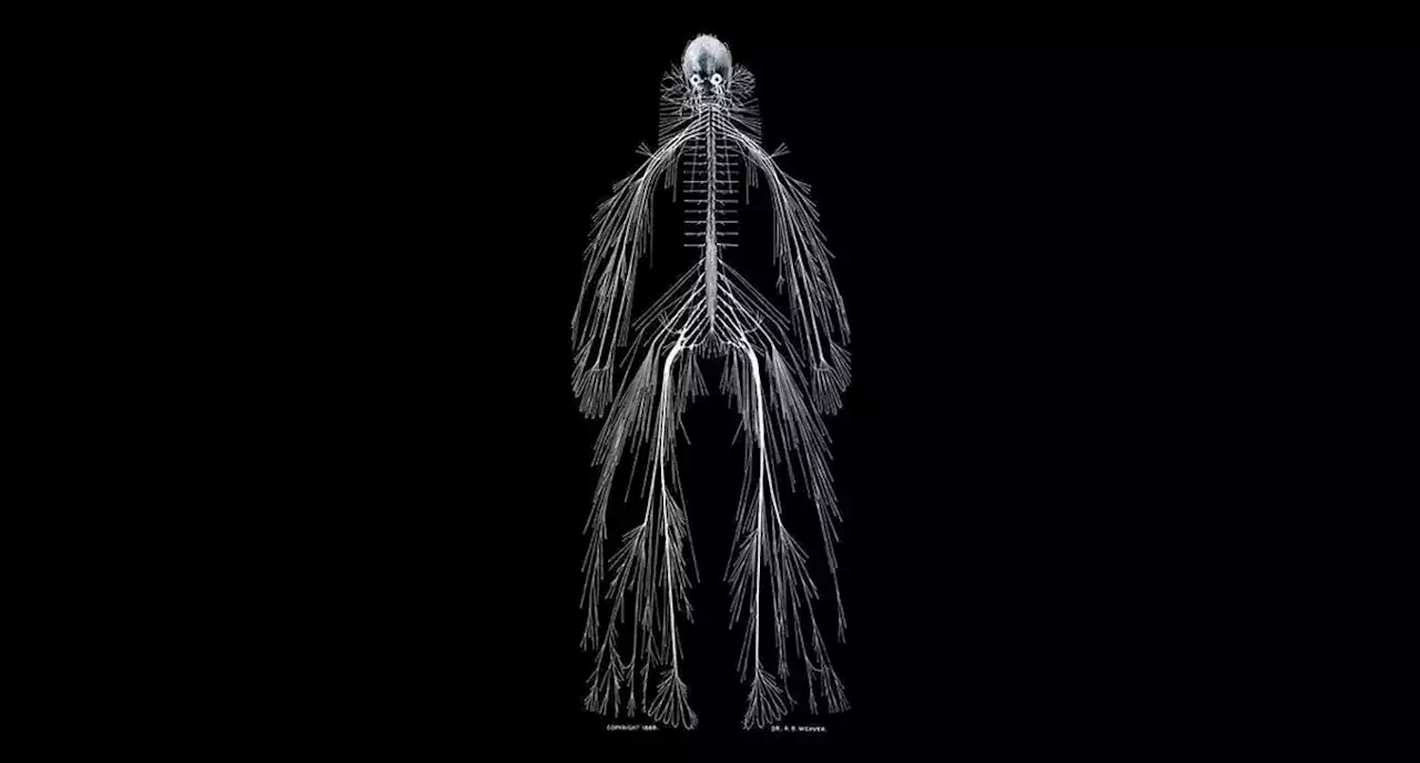 Does This Picture Show a Fully Dissected Human Nervous System?