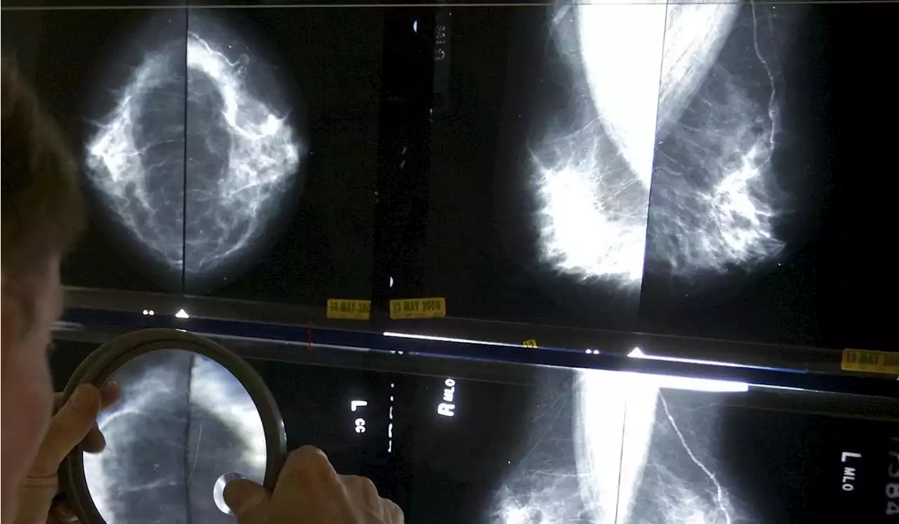 U.S. requires new info on breast density with all mammograms