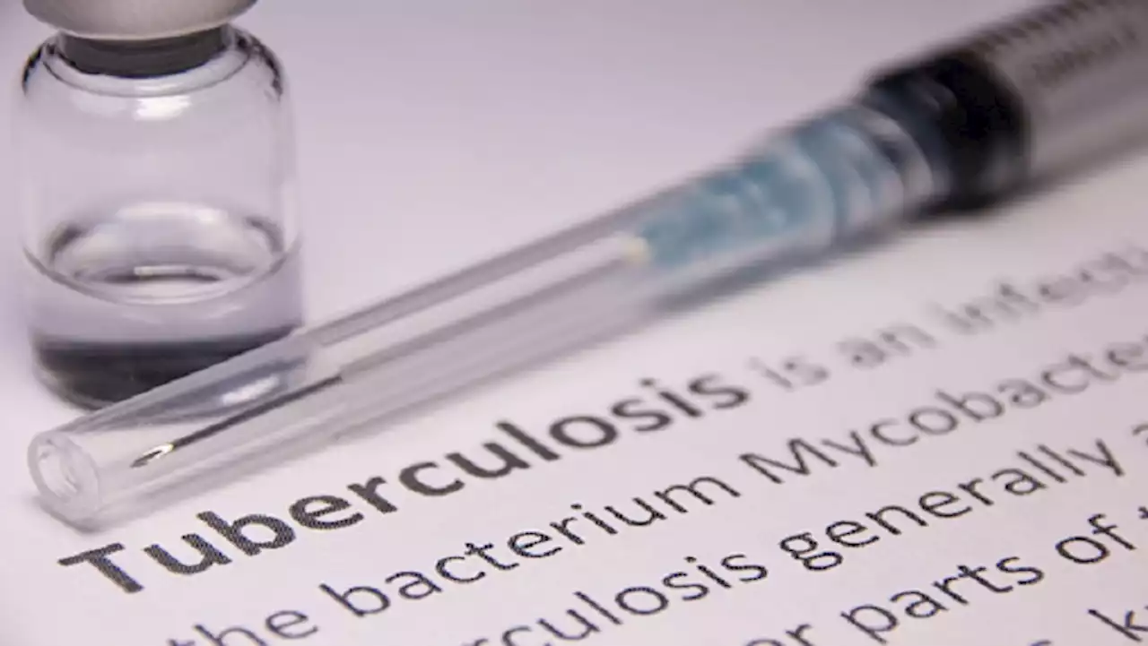 UCT leads new innovation to fight TB - SABC News