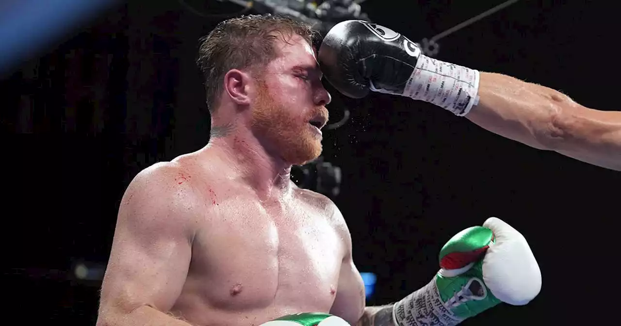 Canelo Álvarez revela que recientemente tuvo parálisis facial ¡por estrés!