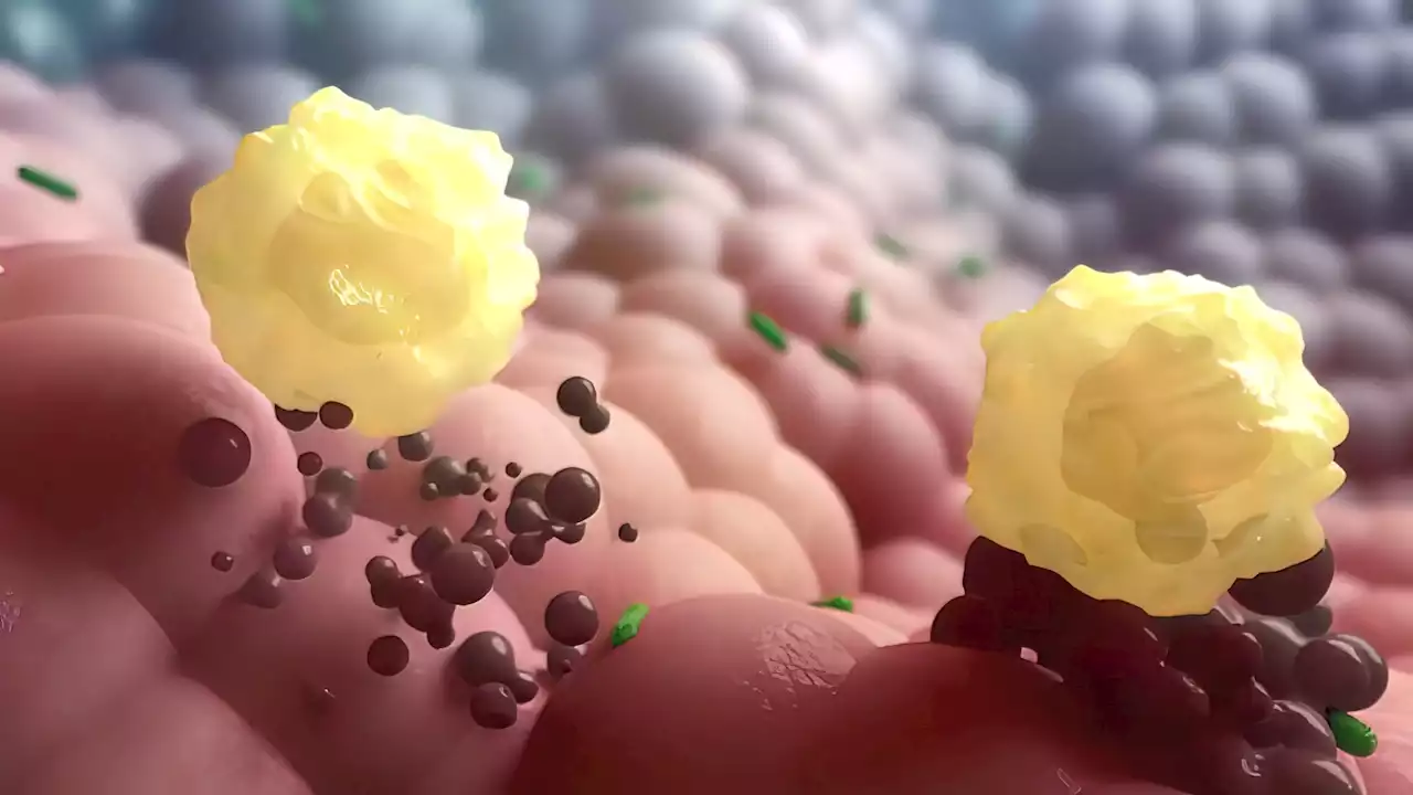 COVID mRNA vaccines fall short in eliciting lung resident memory T cells compared to natural infection