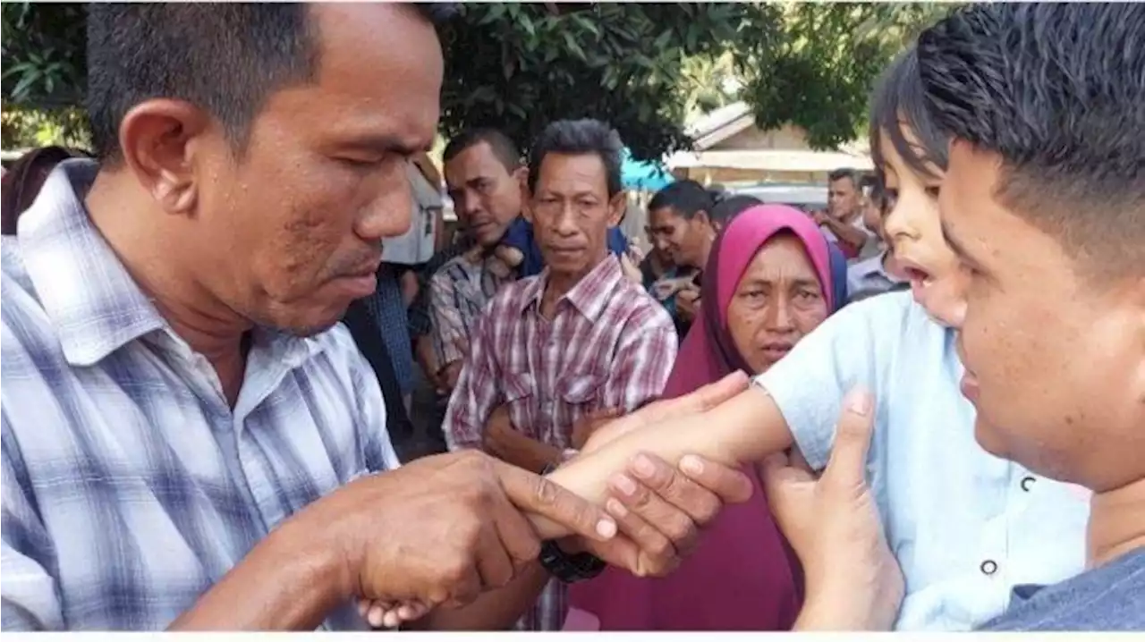 Fakta-fakta Pengobatan Bang Man dari Aceh, Sama-sama Viral seperti Ida Dayak - Tribunnews.com