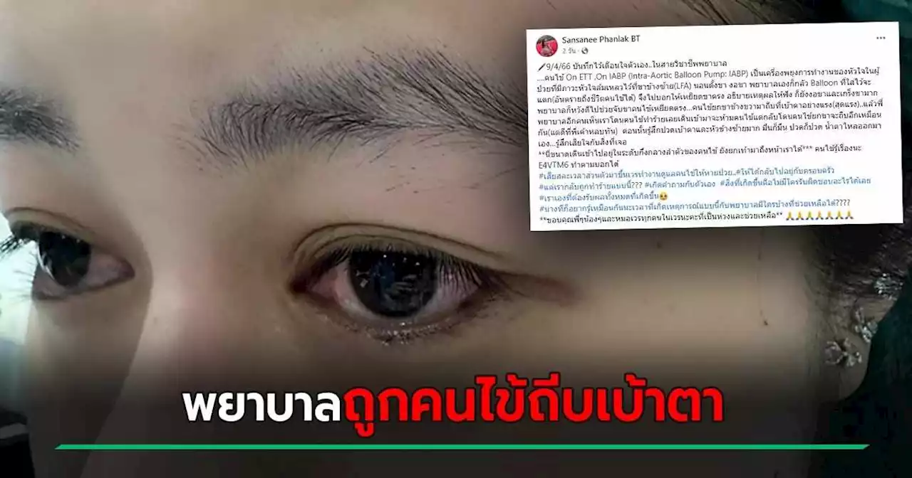 พยาบาลท้อใจ เสียสละเวลาส่วนตัวขึ้นเวร แต่ถูกคนไข้ทำร้าย ถีบเข้าเบ้าตาสุดแรง !