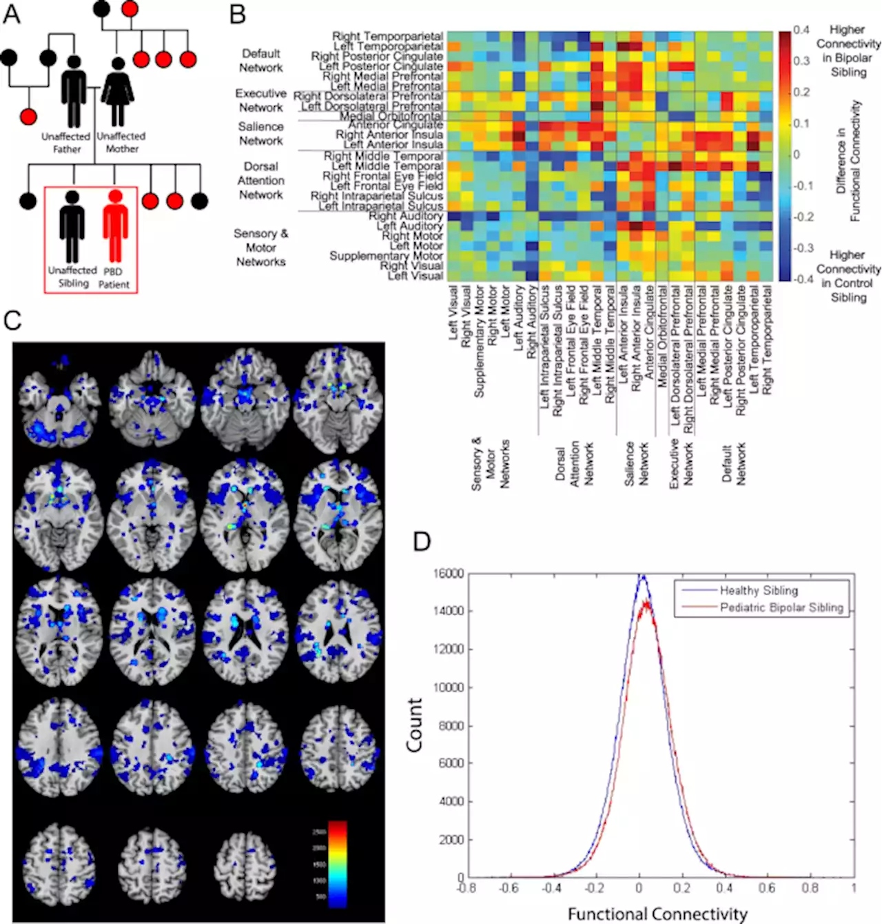 Neurite outgrowth deficits caused by rare PLXNB1 mutation in pediatric bipolar disorder - Molecular Psychiatry