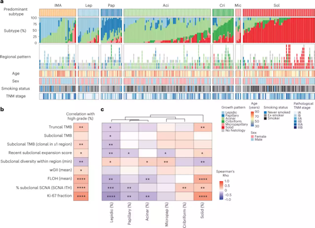 Evolutionary characterization of lung adenocarcinoma morphology in TRACERx - Nature Medicine