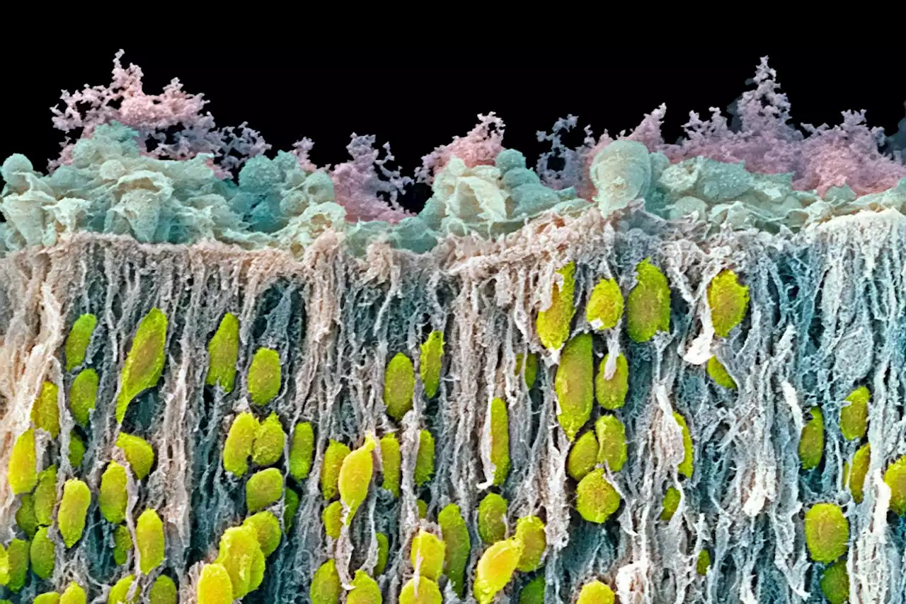 Roots of five medical conditions shown in map of the developing brain