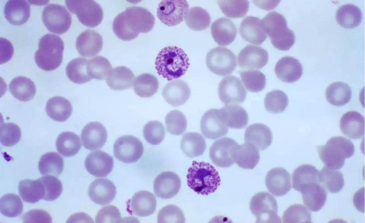 Ghana Becomes First Country to Approve 'World-Changer' Malaria Vaccine
