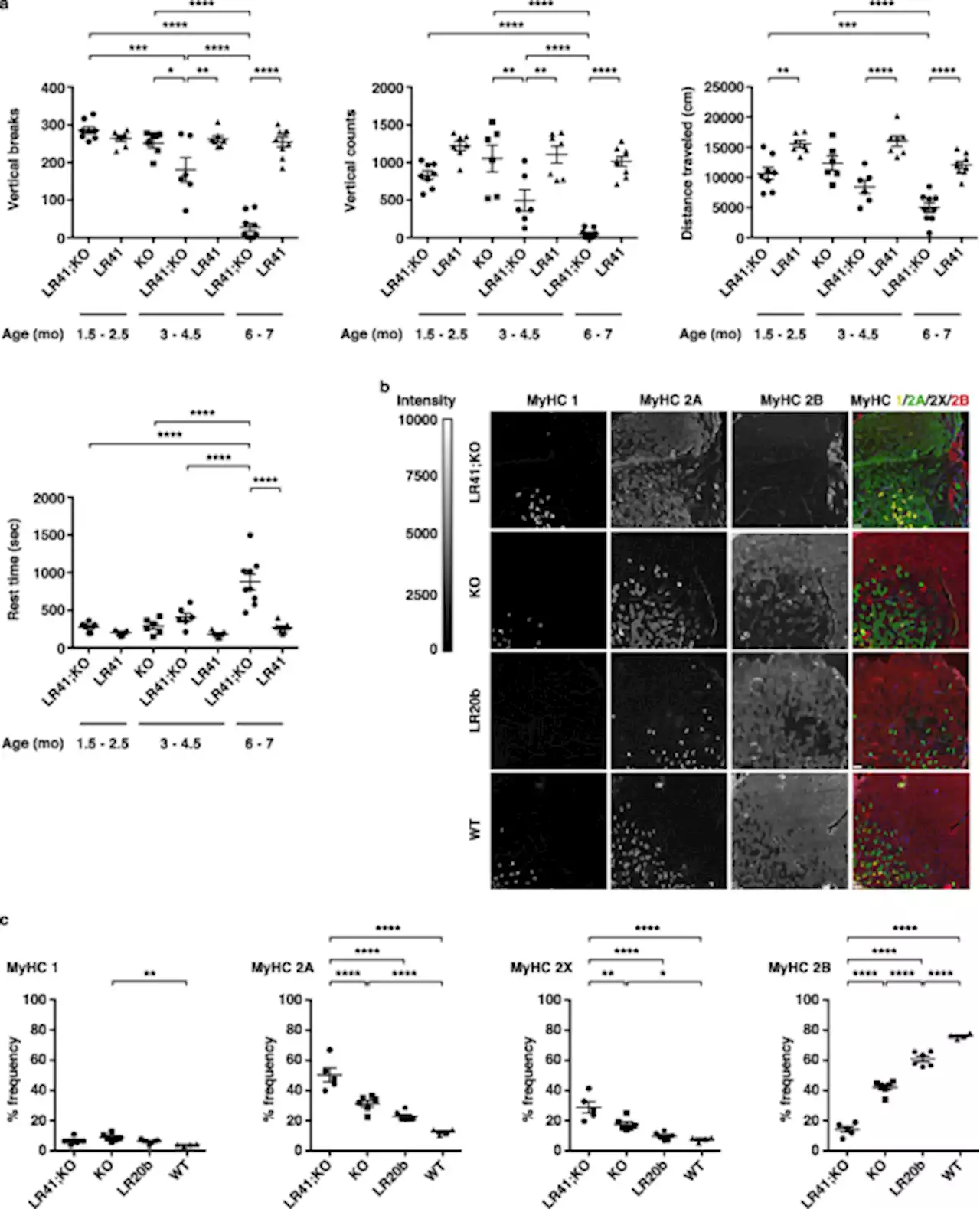 Correction of Clcn1 alternative splicing reverses muscle fiber type transition in mice with myotonic dystrophy - Nature Communications