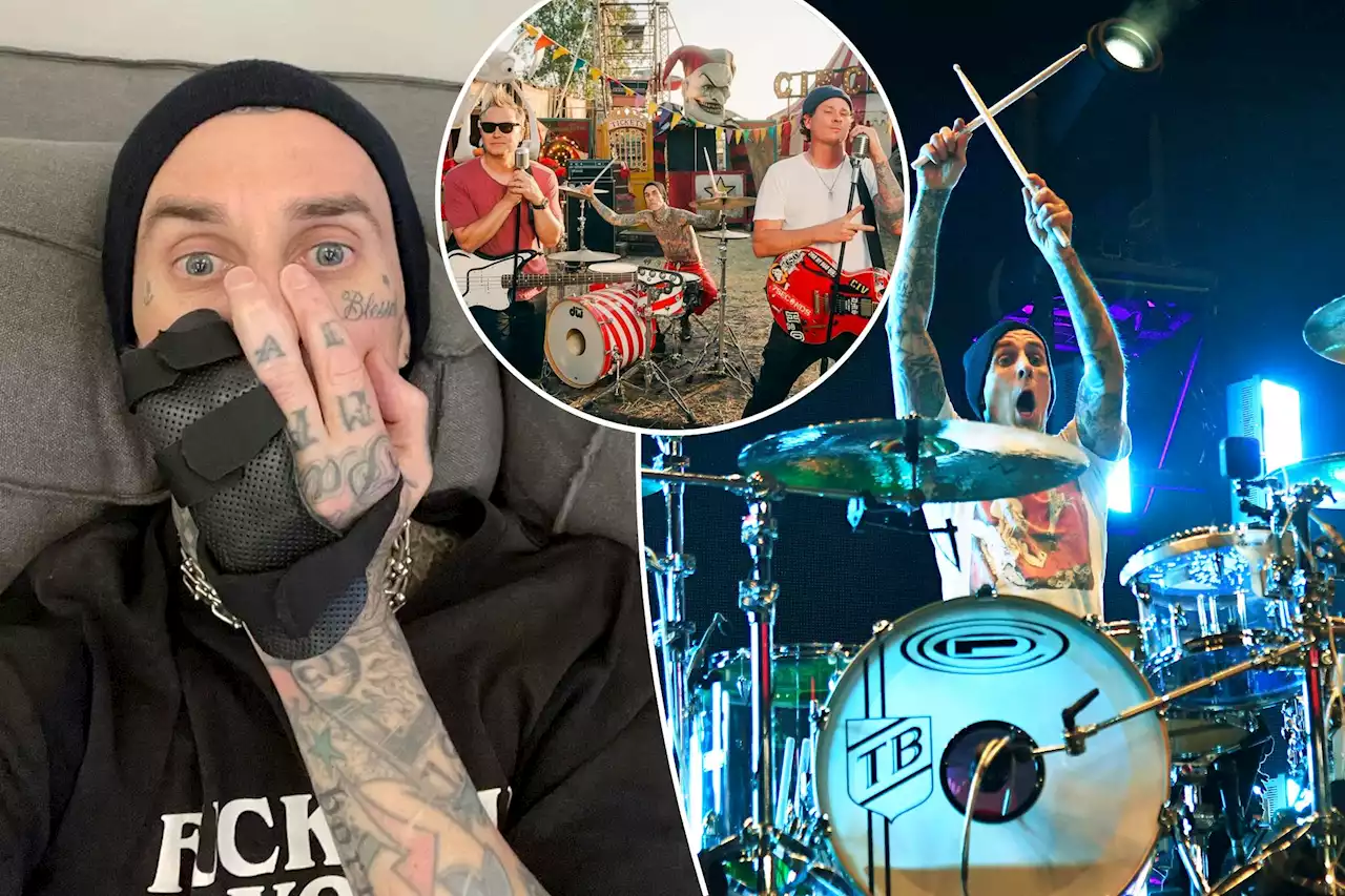 Blink-182 members to reunite, play Coachella following Travis Barker’s surgery