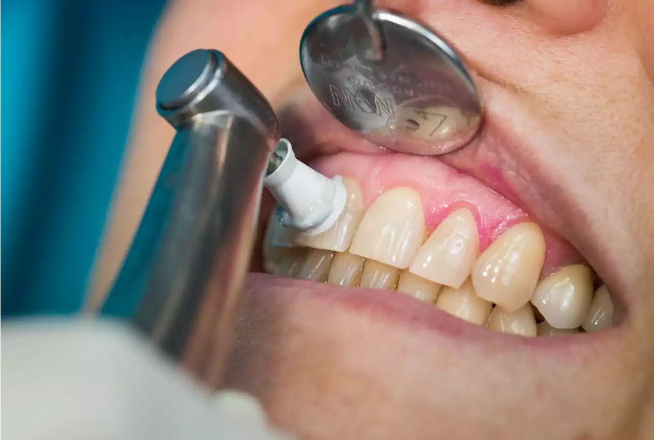 Health Ministry nabs four in crackdown on unlicensed dentists