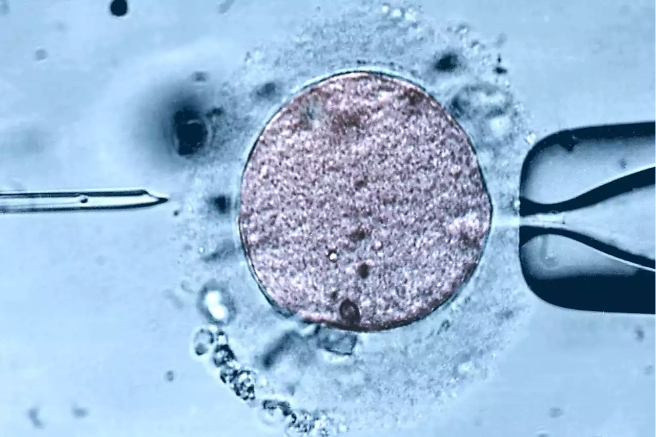 Test showing if sperm can puncture an egg may guide fertility therapy