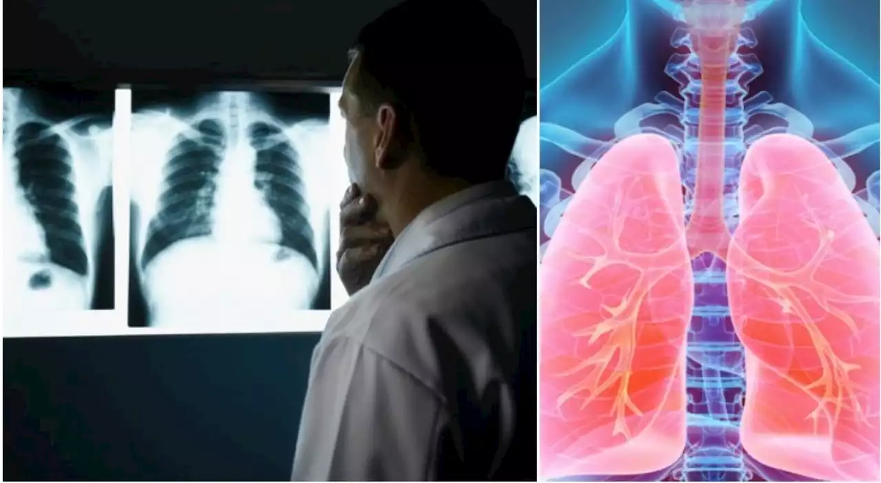 Il tumore «si evolve, sopravvive e si diffonde in tutto il corpo»: lo studio “senza precedenti” su aggressività e cure universali