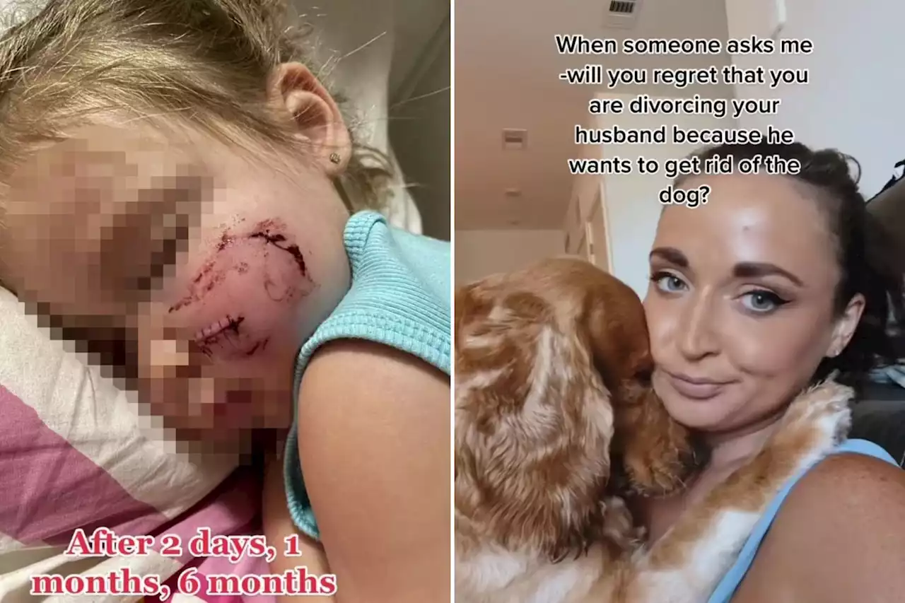 Mum slammed for keeping her pet dog after it mauled daughter's face