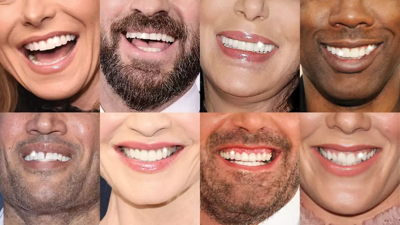 The High-Tech Hollywood Smile: How 3D Scanners and Artificial Intelligence Are Perfecting Teeth