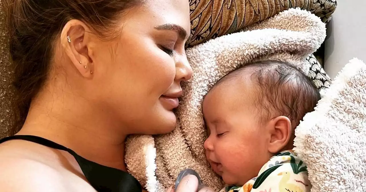 Chrissy Teigen Embraces ‘Lifetime Scars,’ Post-Baby Body in Nude Photo