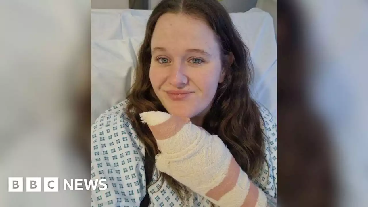 False widow spider bite victim felt finger 'would explode' with pain