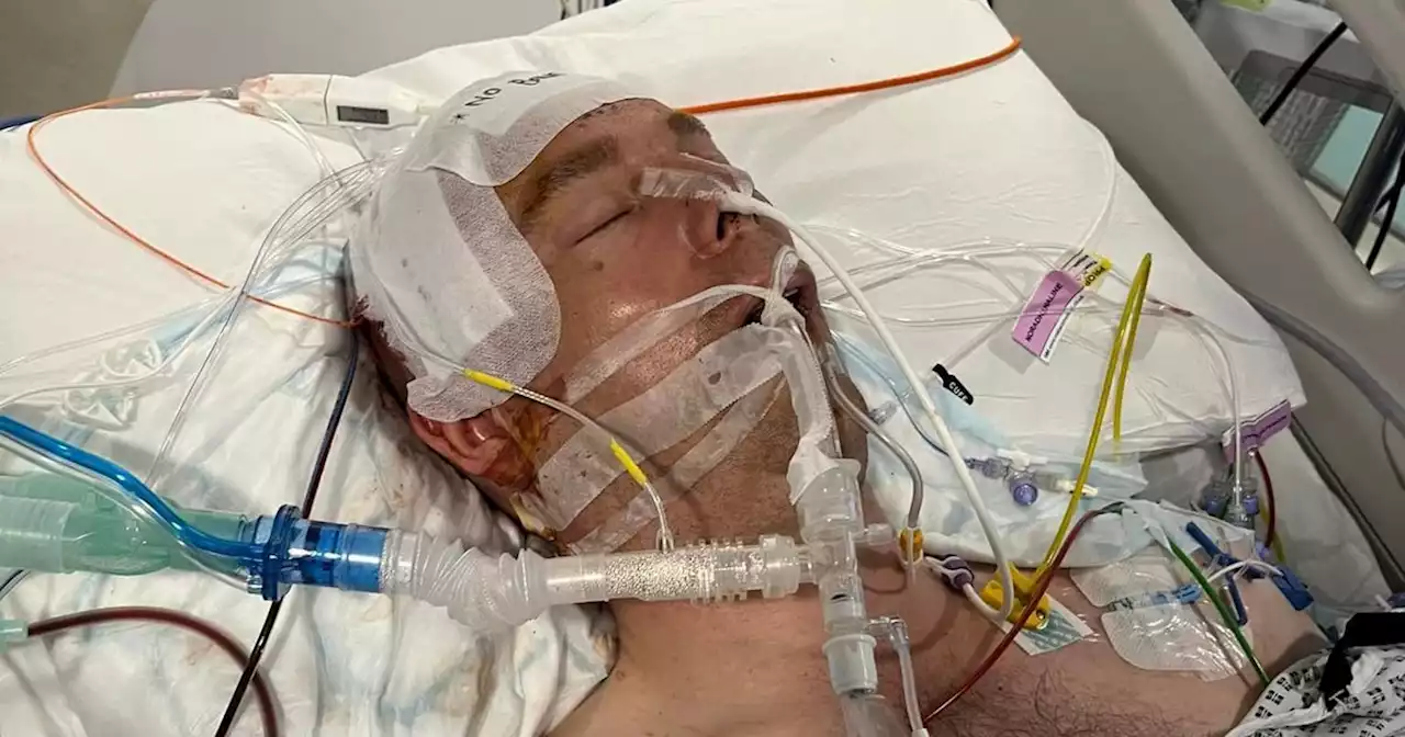 Dad fighting for his life after brutal bar attack just weeks before wedding