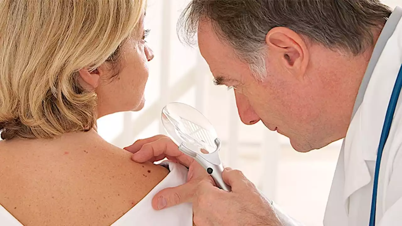 USPSTF Issues Updated Recommendations on Skin Cancer Screening