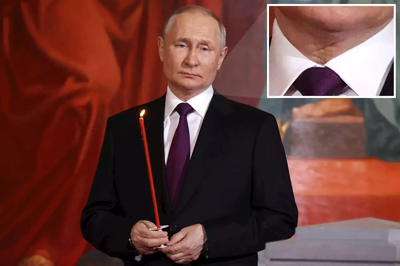 Scar on Putin’s neck sparks health rumors