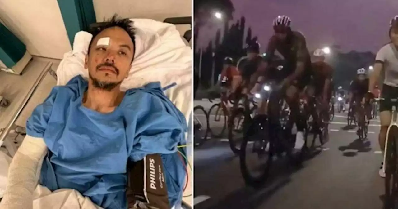 'Egos got the better of them': Cyclist crashes and suffers brain bleed after group overtakes his