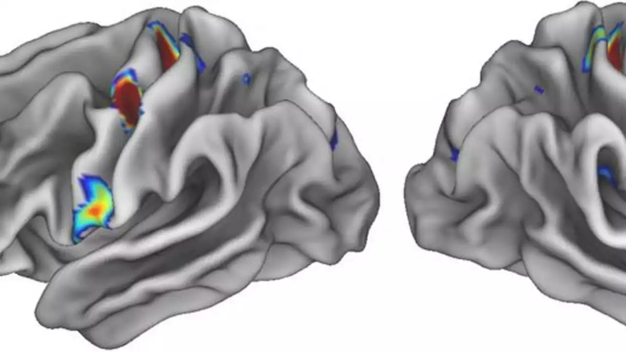 Scientists identify mind-body nexus in human brain