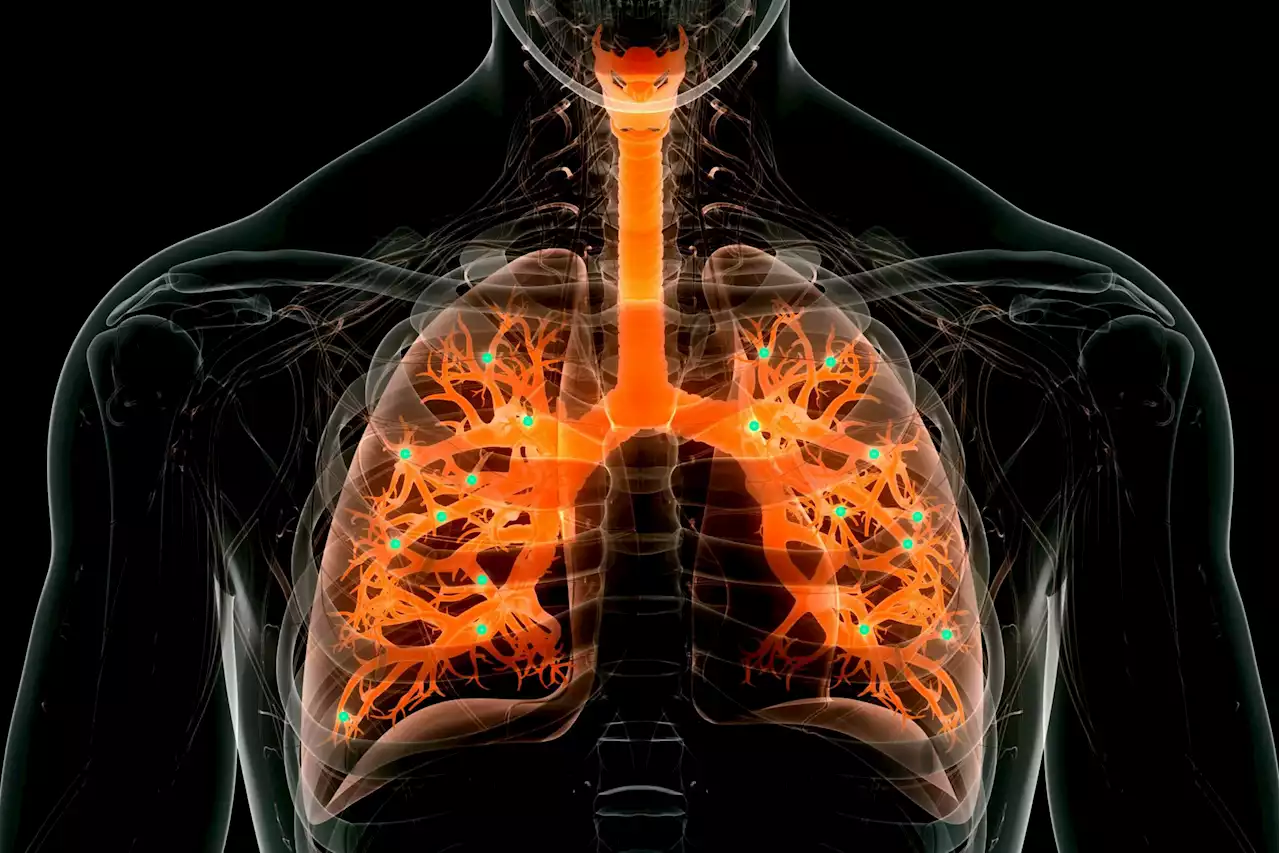 MIT Pioneers Gene Editing mRNA Nanoparticles To Combat Lung Diseases