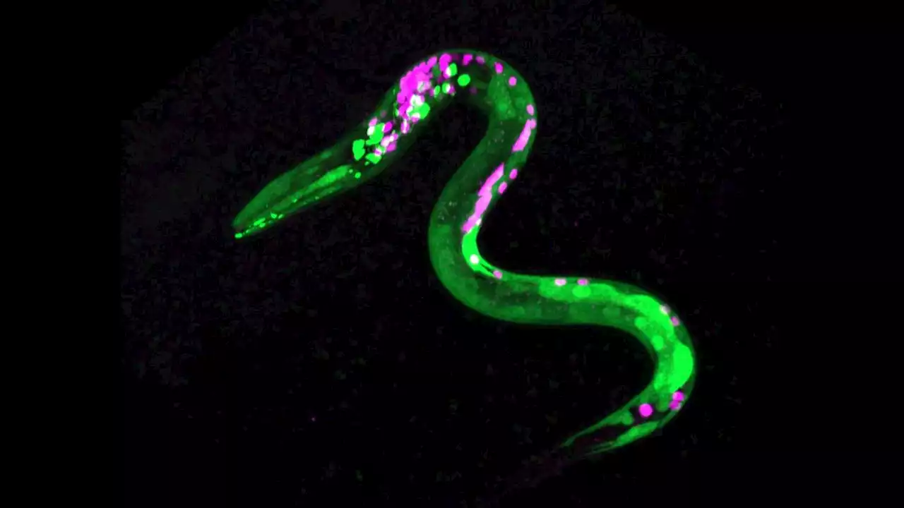 Worms and humans both get 'the munchies,' despite 500 million years of evolutionary separation