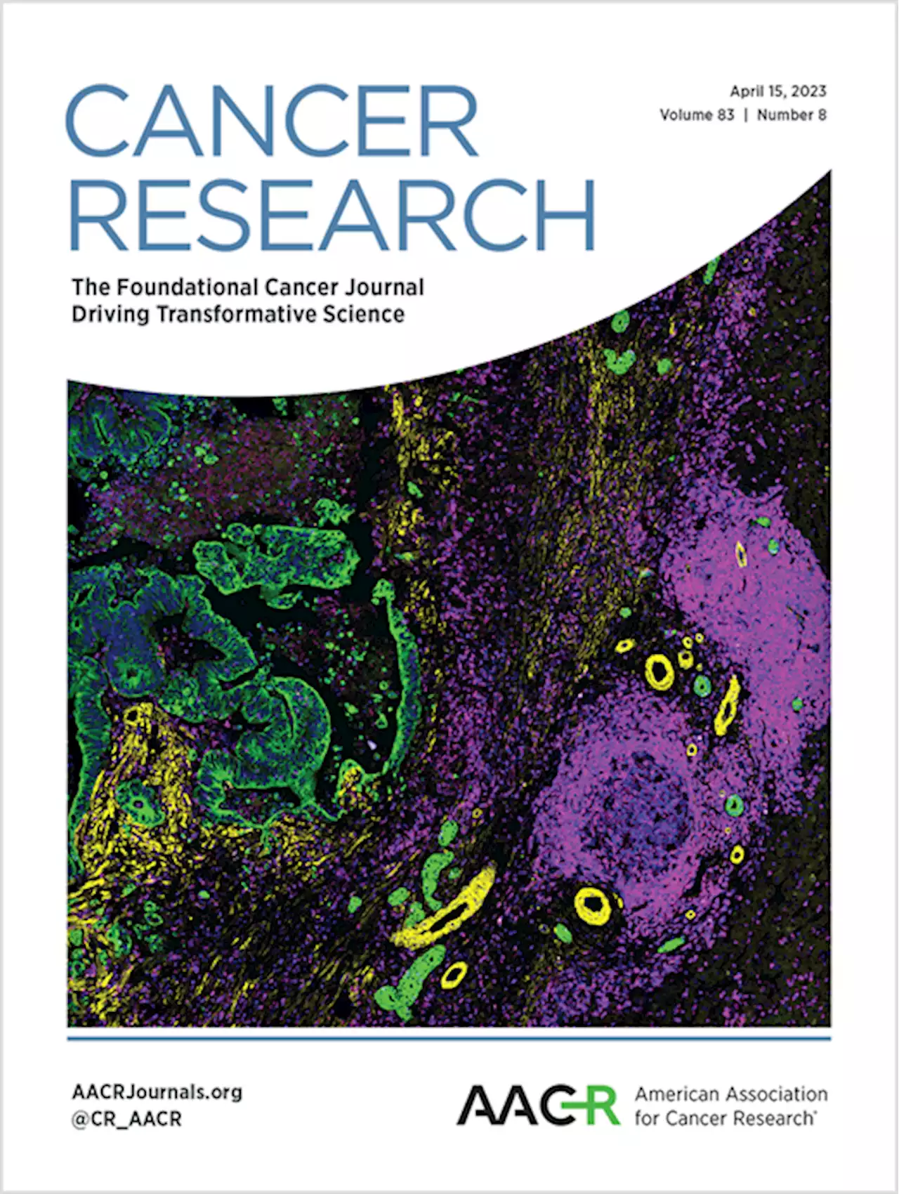 TONSL Is an Immortalizing Oncogene and a Therapeutic Target in Breast Cancer