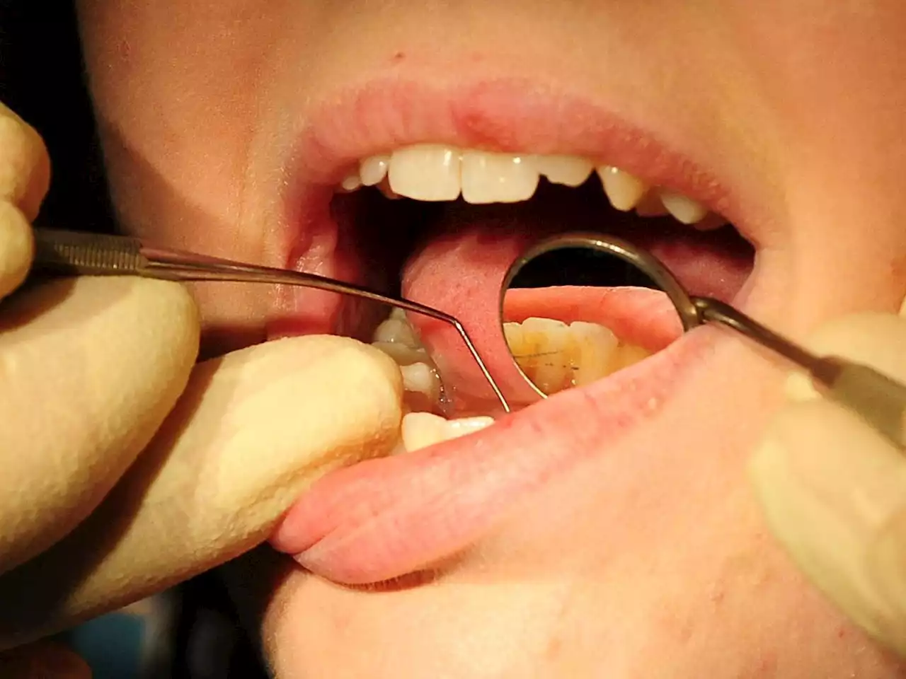 County facing pandemic dental patient backlog amid struggle to recruit new dentists