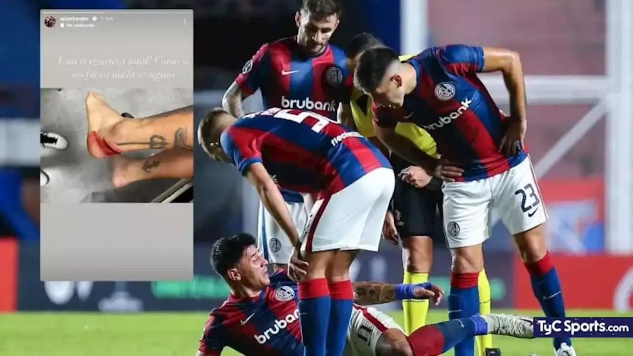 FUERTE posteo de BAREIRO tras la derrota de SAN LORENZO: 'UNA VERGÜENZA TOTAL' - TyC Sports