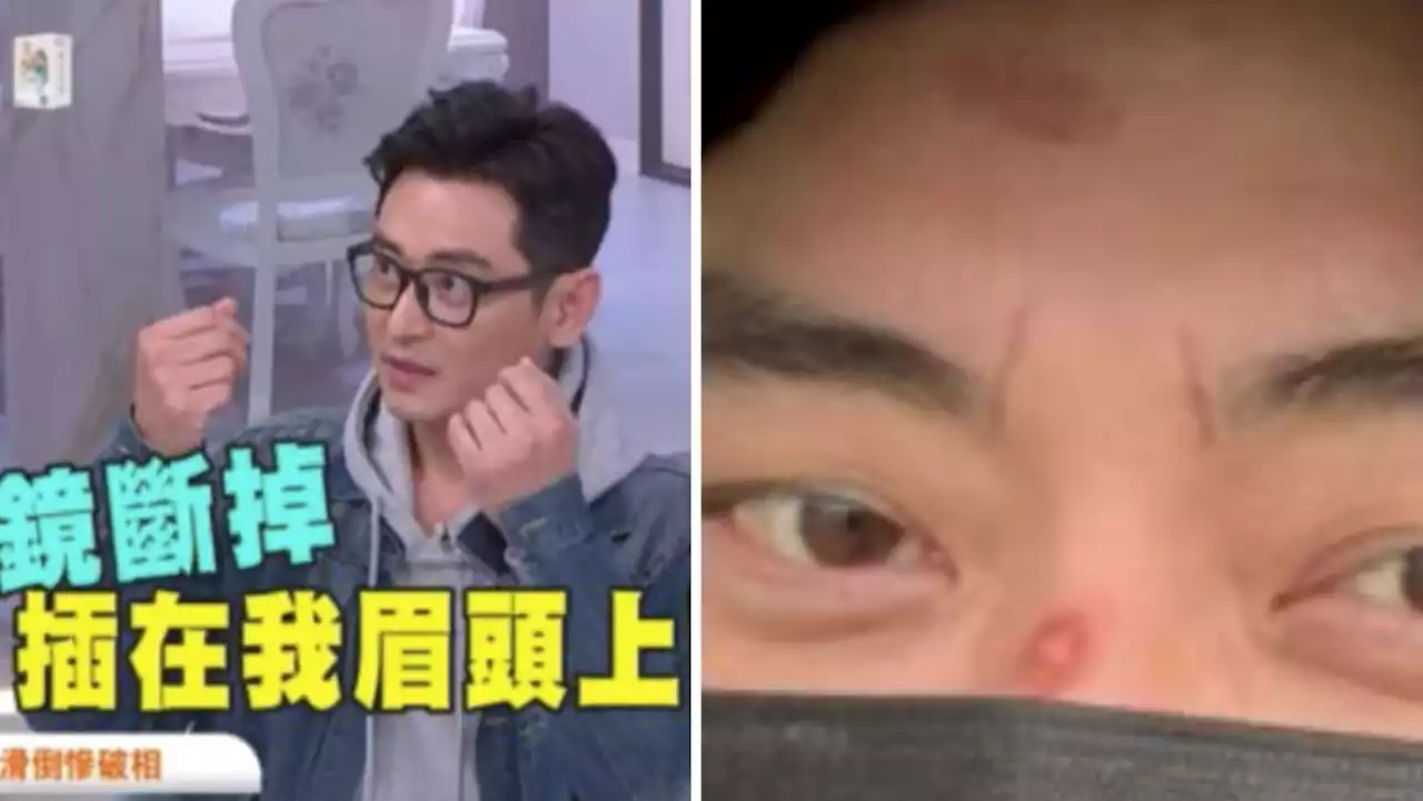 Freak accident: Taiwanese actor Norman Chen fell on his face, his spectacles broke and pierced his forehead