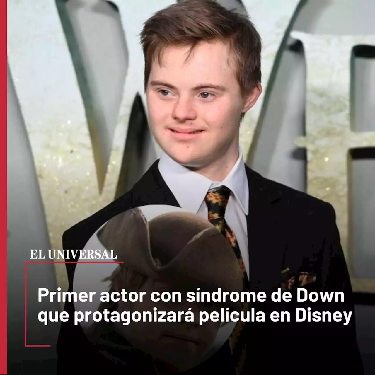 Primer actor con síndrome de Down protagonizará película en Disney