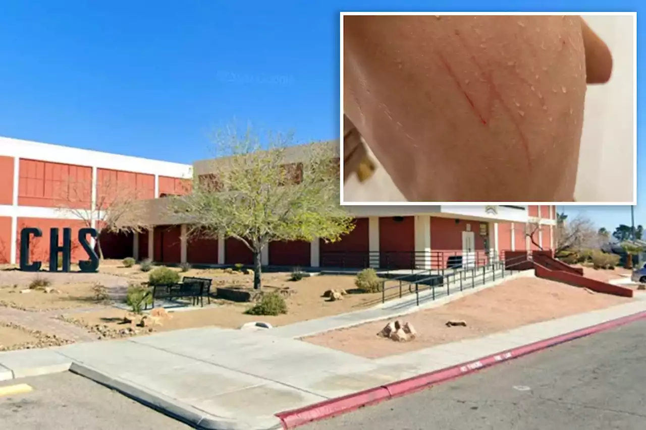 Autistic Jewish teen is attacked, has swastika carved on his back at Las Vegas high school