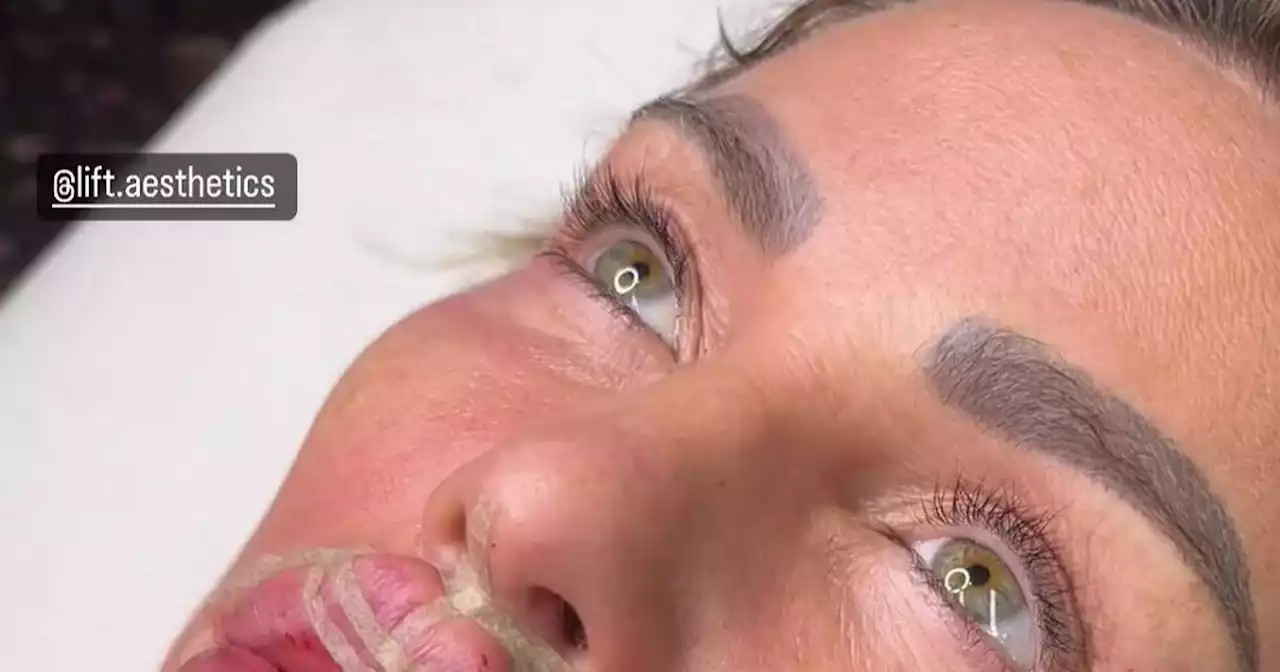 Katie Price pouts as she gets more work done - this time '3D Butterfly lips'