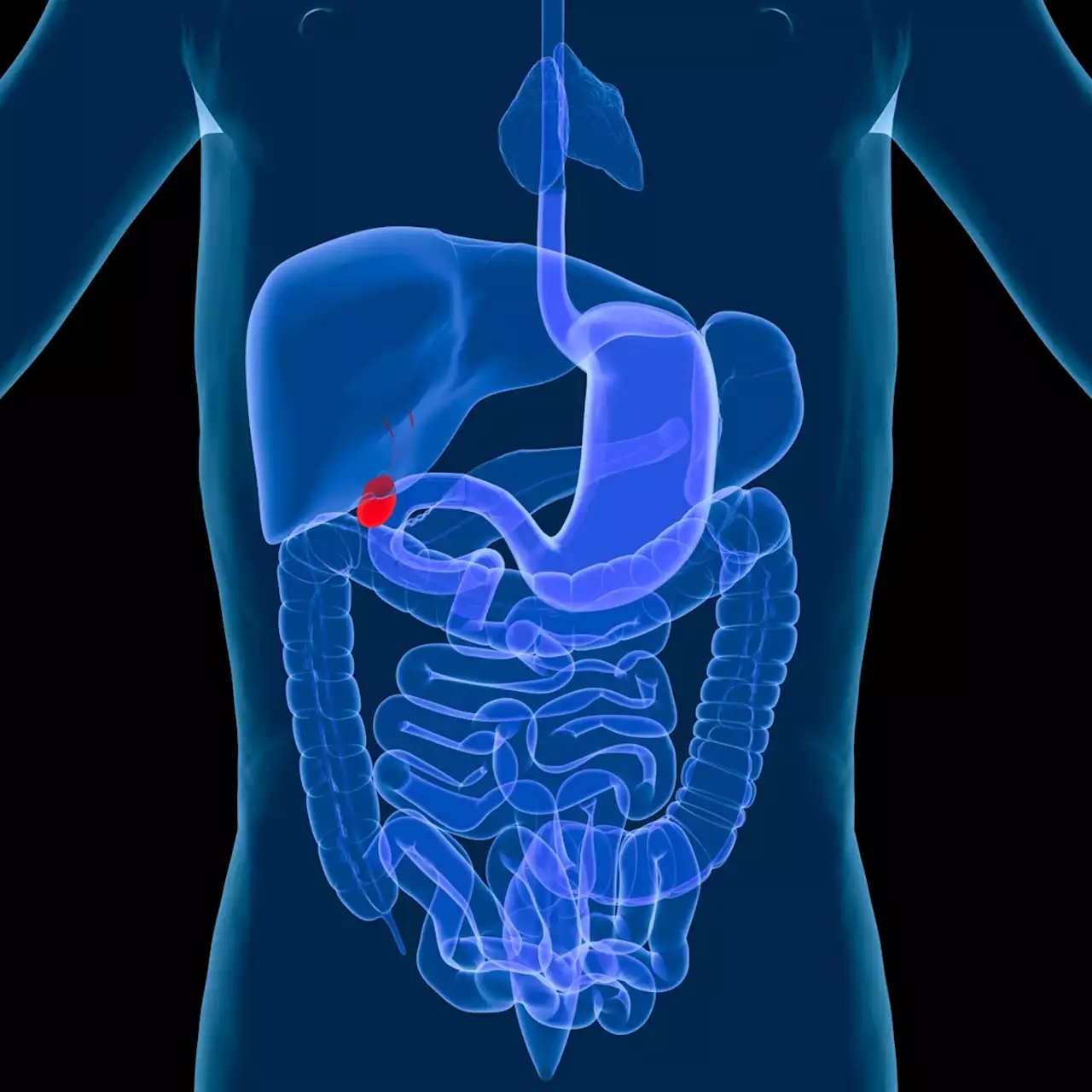 Claire Nielsen: Gallbladder plays huge role in our digestive health