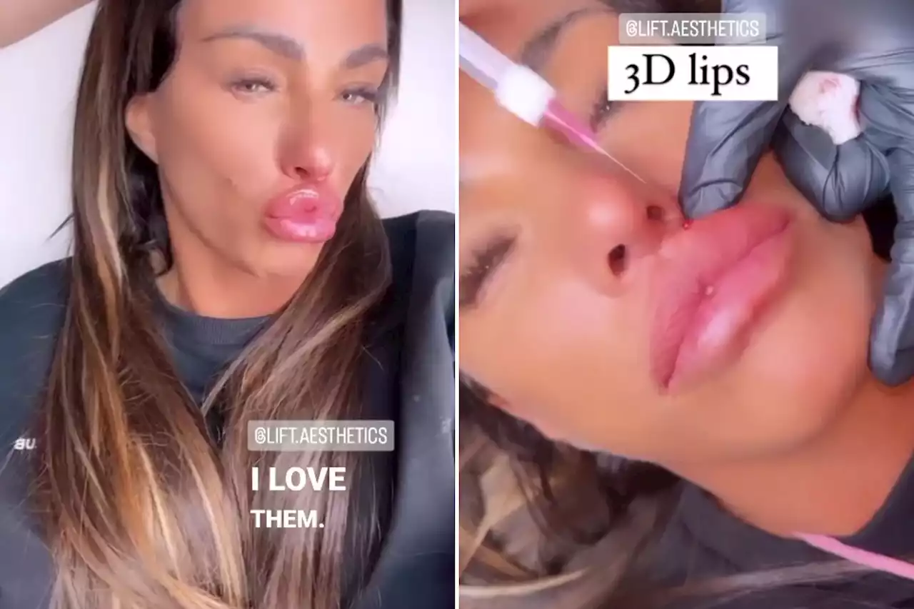 Katie Price shows off her huge new lips after getting filler injected