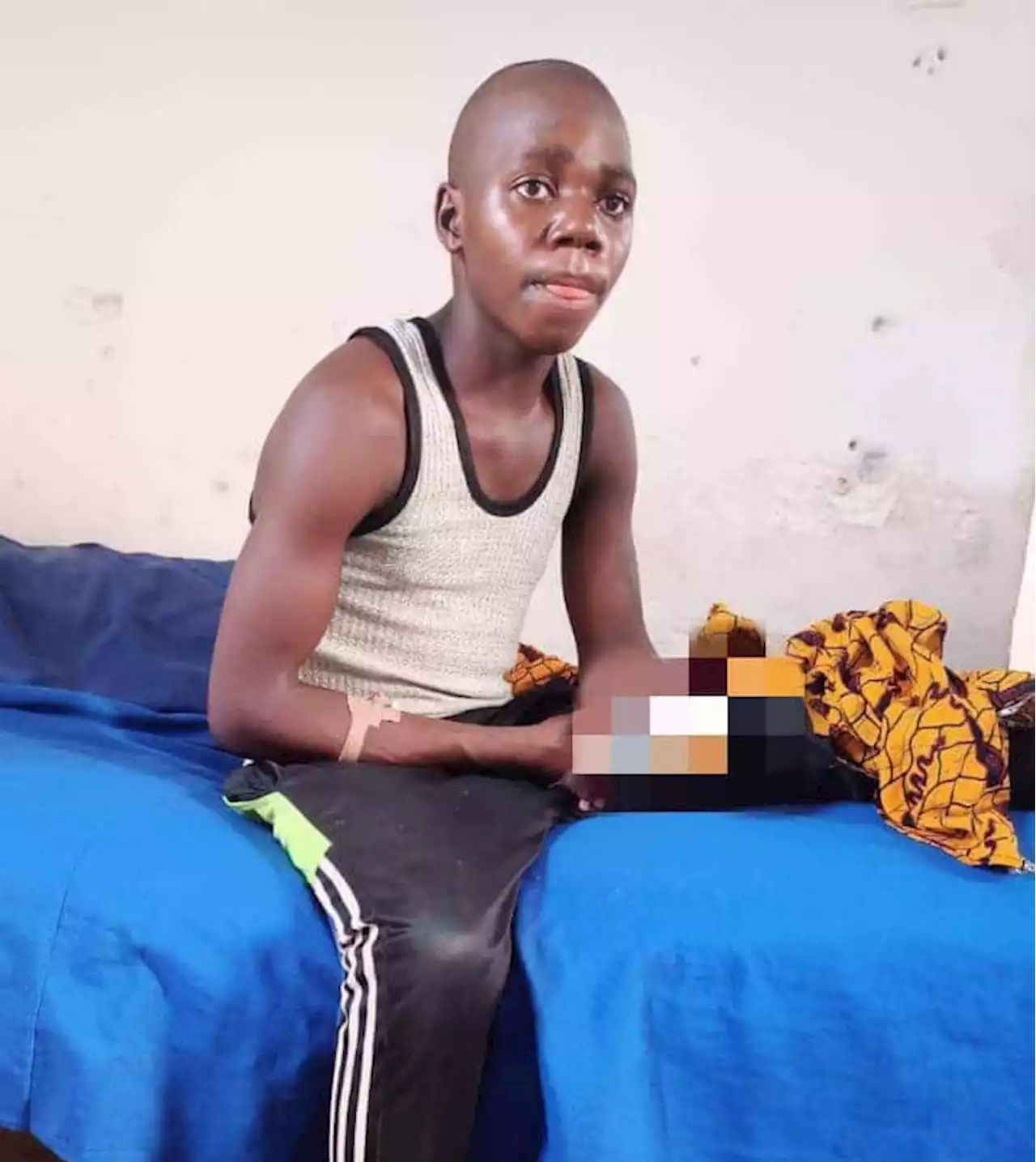 Teenager recounts ordeal as bandits cut off arm despite paying ransom