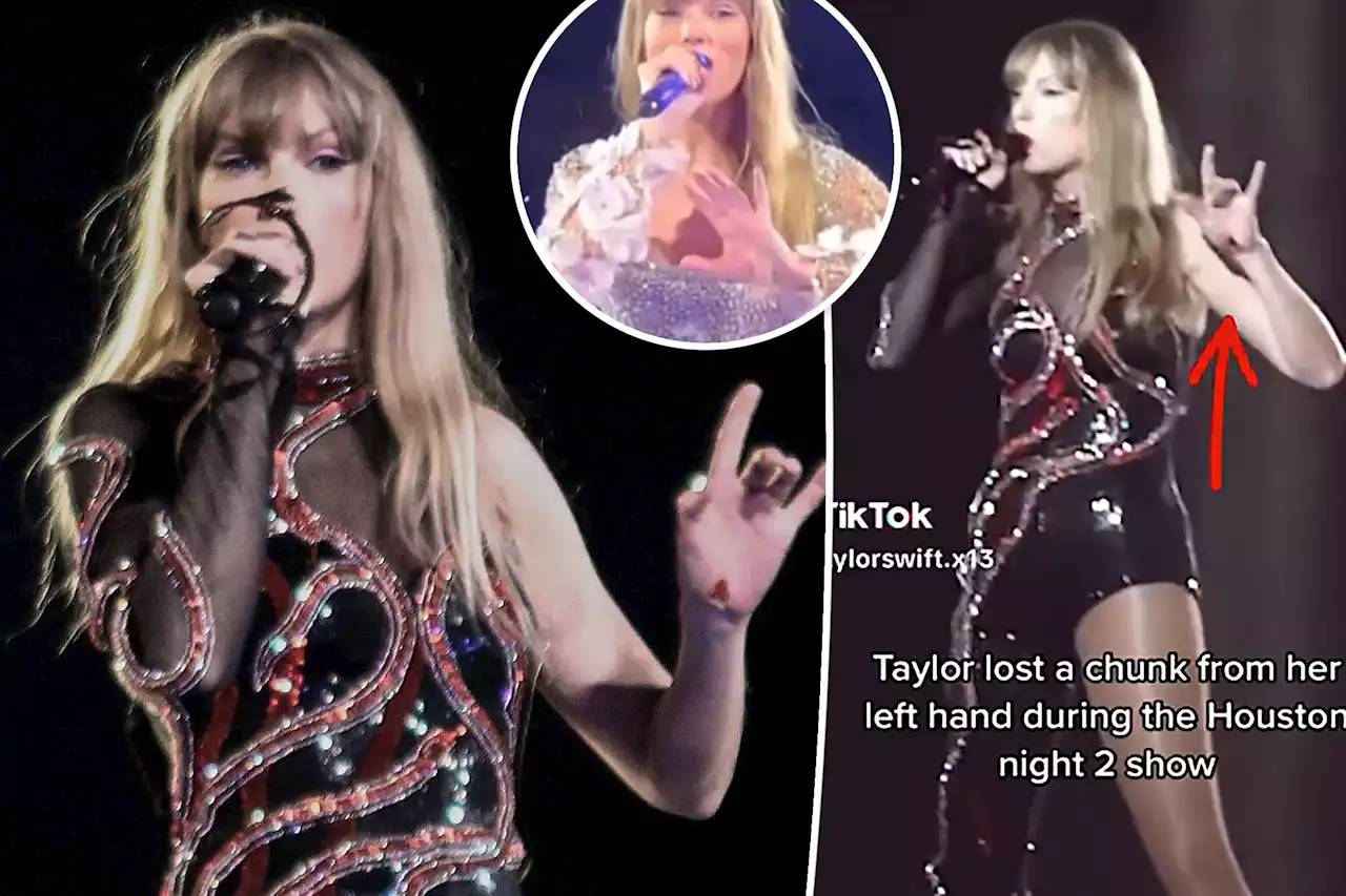 Taylor Swift reveals backstage injury after fans notice hand wound: ‘Totally fine’