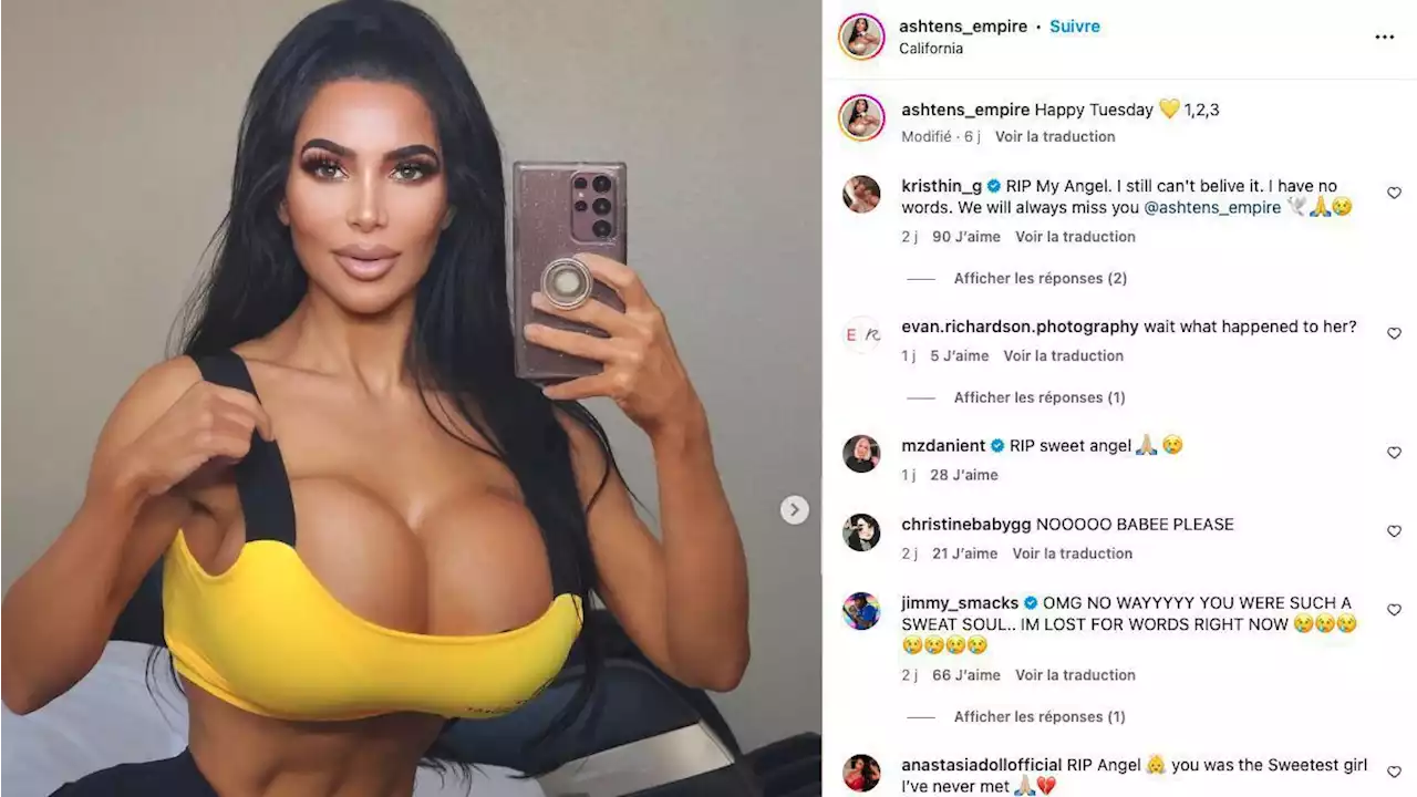 Sosie de Kim Kardashian, une jeune femme de 34 ans meurt après son ultime opération