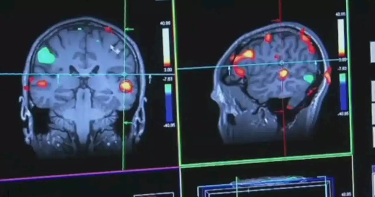 BYU scientists revolutionize detecting and treating Alzheimer's