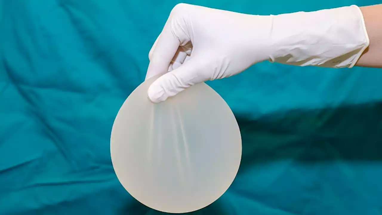 SCC From Breast Implants: Negligible Risk, Study Finds