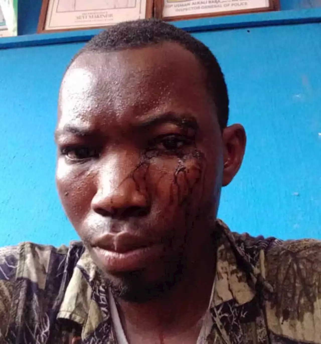 Silverbird TV Reporter Attacked, Brutalised By Nigerian Police For Filming Riot Incident In Oyo | Sahara Reporters