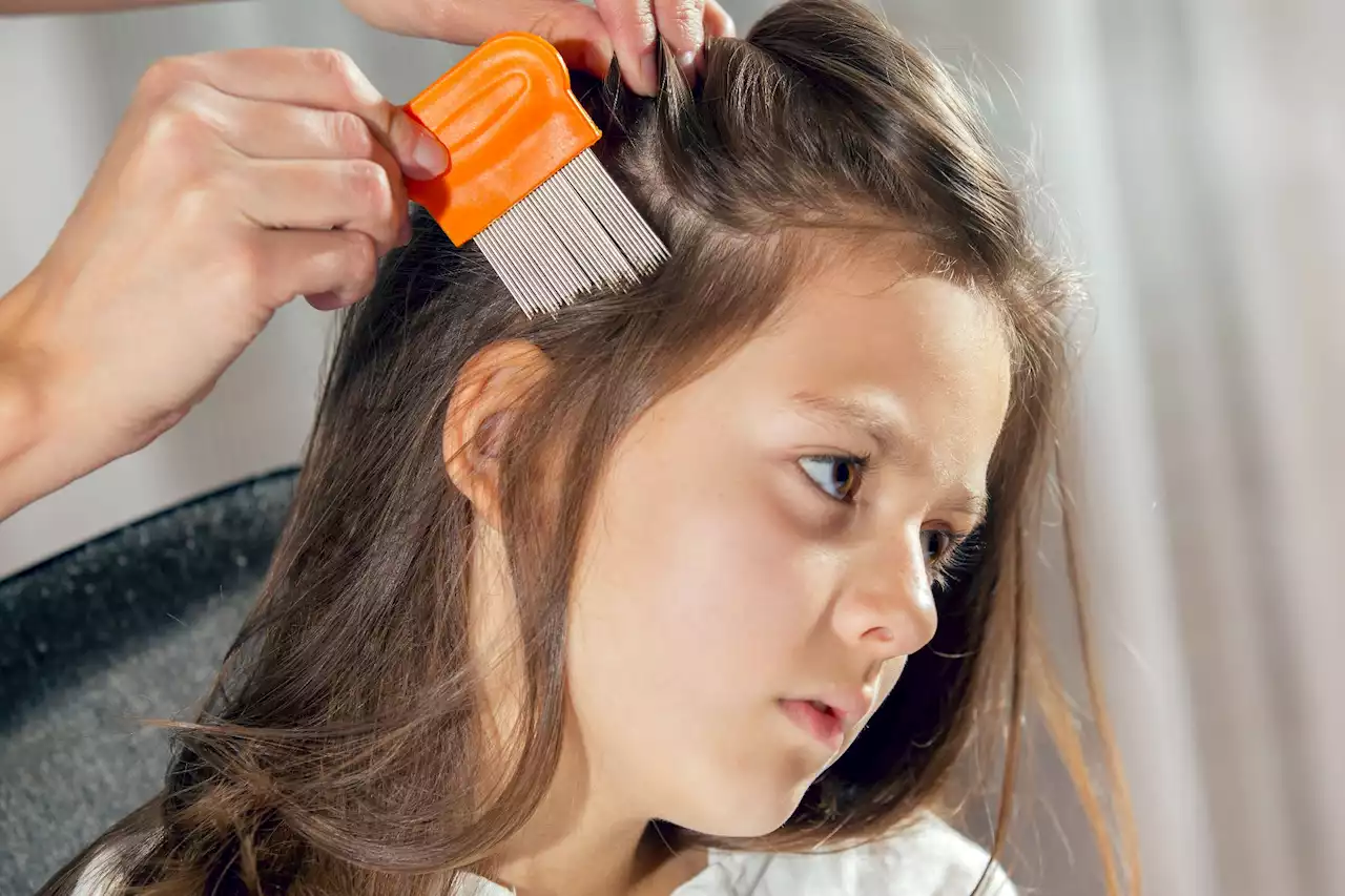 Common head lice treatment 'increases child's risk of severe behavioural issues'